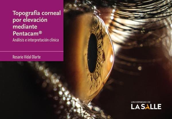 795856_IMAGEN_TAPA_G_001 Topografía corneal por elevación mediante Pentacam®: Análisis e interpretación clínica - Imagen 1