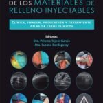 Efectos adversos de los materiales de relleno inyectables